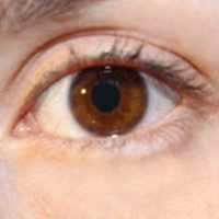 EyeInj EyeInj